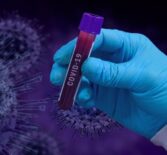 Когда закончится пандемия вируса Covid 19?