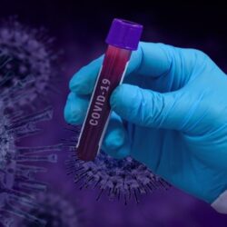 Когда закончится пандемия вируса Covid 19?